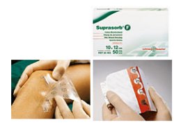 MEDICAZIONE STERILE IN FILM IN POLIURETANO TRASP. SUPRASORB F 10X12CM 10 PEZZI - Farmacia Rossi2 - Farmacia Rossi 