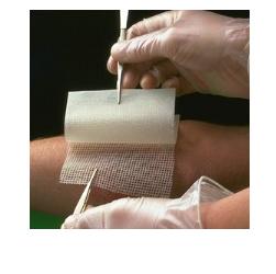 GARZA MEDICATA BACTIGRAS CON CLOREXIDINA ACETATO 0,5% 15X20CM 10 PEZZI - Farmacia Rossi2 - Farmacia Rossi 